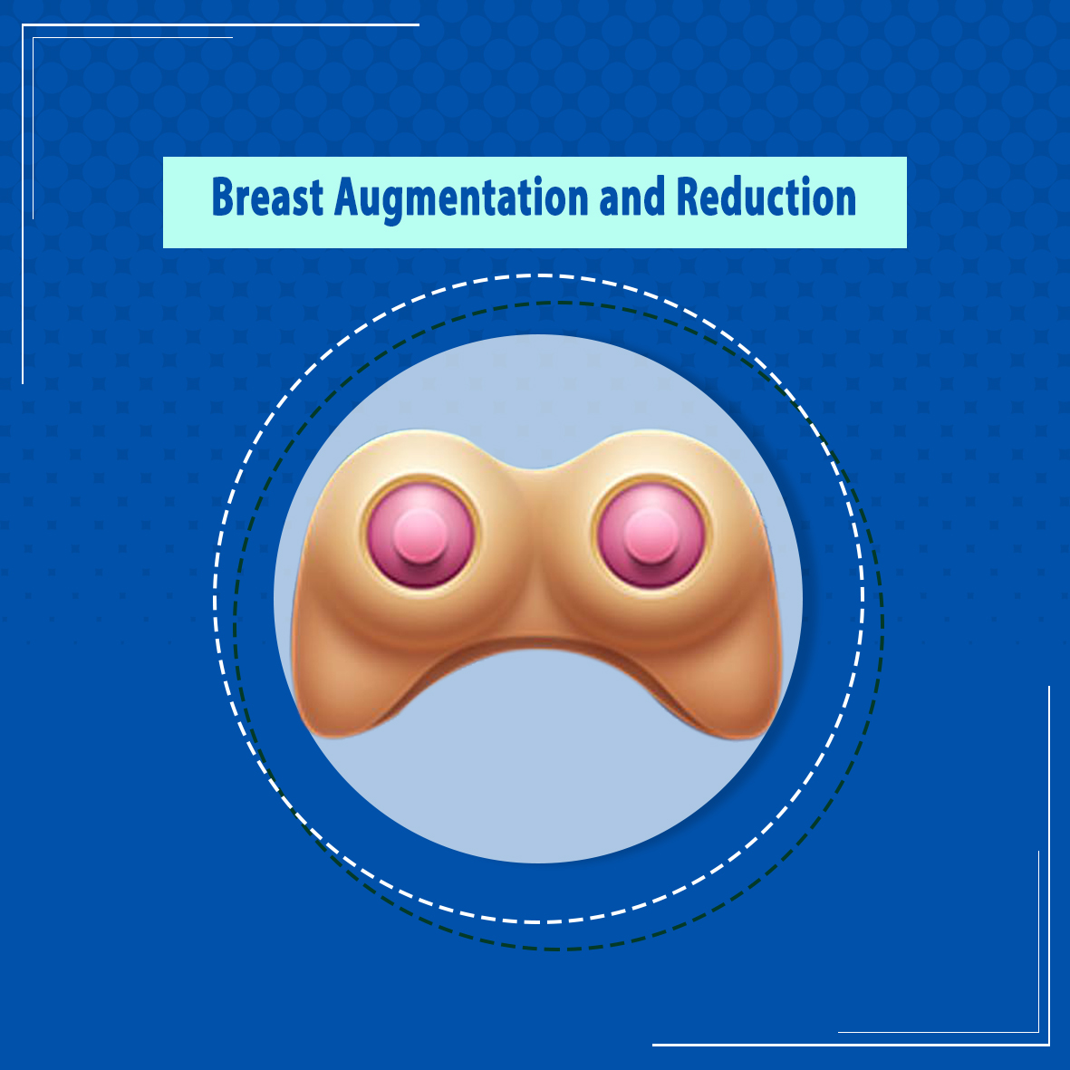 Breast augmentation and reduction