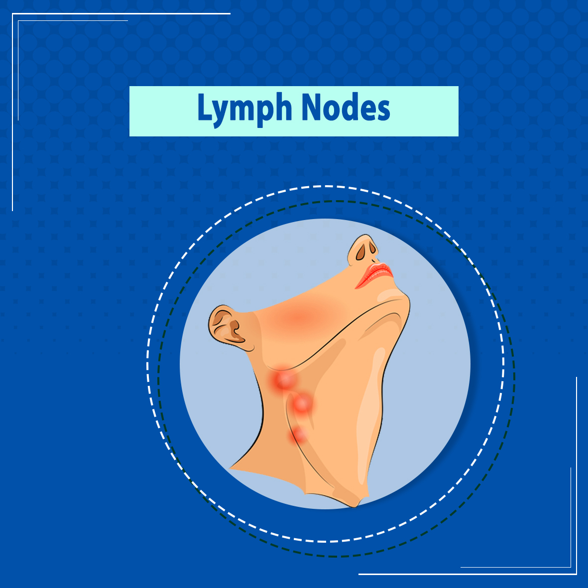 Lymph Nodes