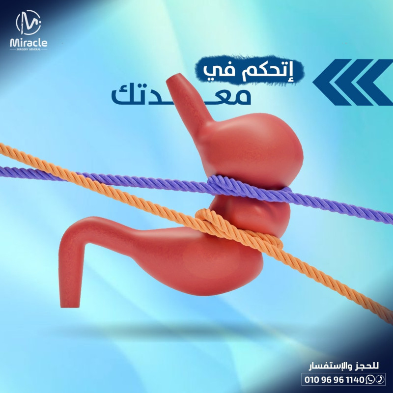  تكميم المعدة بالمنظار 