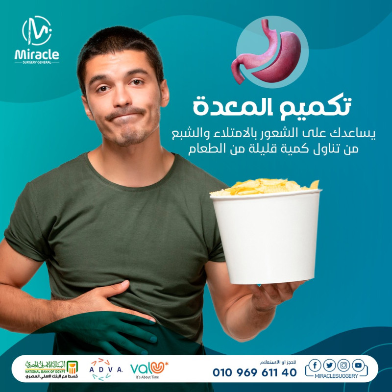  تكميم المعدة بالمنظار 