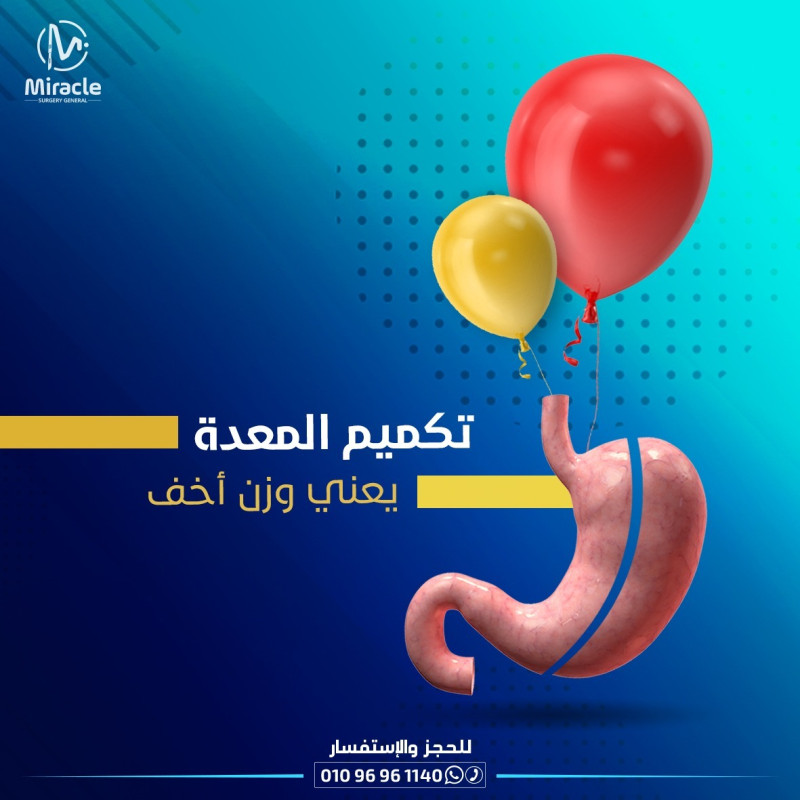  تكميم المعدة بالمنظار 